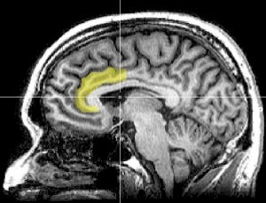 Cerebro e ideologías